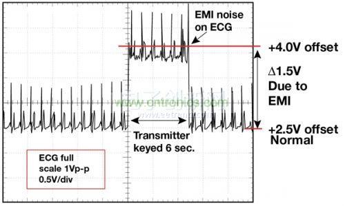 1.5 英尺以外的發(fā)射器（f = 470 MHz, P= 0.5W）開啟和關(guān)閉時ECG 診斷設(shè)備的心臟檢查結(jié)果