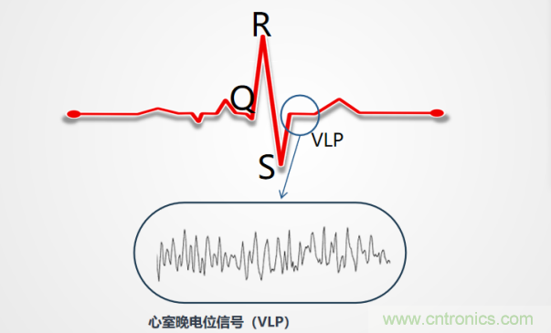 解決心電監(jiān)測行業(yè)難題，曼森伯格的濾波技術獲國家知識產(chǎn)權局發(fā)明授權